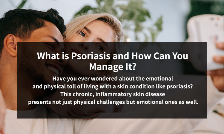 What is Psoriasis and How Can You Manage It?